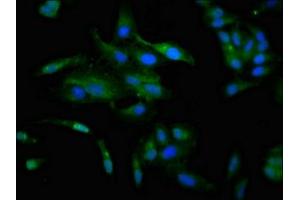 Immunofluorescence staining of Hela cells with ABIN7147596 at 1:100, counter-stained with DAPI. (CCKAR Antikörper  (AA 235-313))
