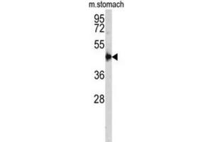 Western Blotting (WB) image for anti-Cathepsin E (CTSE) antibody (ABIN3002688) (Cathepsin E Antikörper)