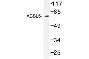 Image no. 2 for anti-Acyl-CoA Synthetase Long-Chain Family Member 6 (ACSL6) antibody (ABIN317844)