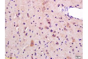 Formalin-fixed and paraffin embedded rat brain labeled with Rabbit Anti JNK2 Polyclonal Antibody, Unconjugated (ABIN681403) at 1:200 followed by conjugation to the secondary antibody and DAB staining