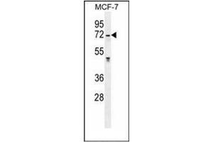 Western blot analysis of GALNS Antibody (Center) in MCF-7 cell line lysates (35ug/lane). (GALNS Antikörper  (Middle Region))
