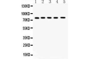Western blot analysis of FSH Receptor expression in rat testis extract ( Lane 1), rat ovary extract ( Lane 2), mouse testis extract ( Lane 3) mouse ovary extract ( Lane 4) and HELA whole cell lysates ( Lane 5).