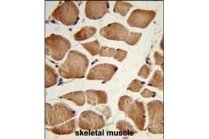 Formalin-fixed and paraffin-embedded human skeletal muscle reacted with NRP1 Antibody (C-term), which was peroxidase-conjugated to the secondary antibody, followed by DAB staining. (Neuropilin 1 Antikörper  (C-Term))