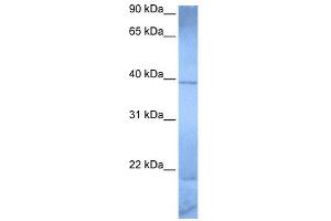 WB Suggested Anti-ZNF121 Antibody Titration:  0.