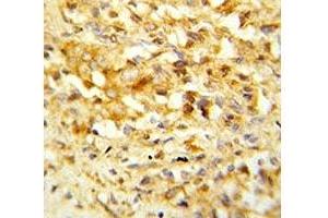 Immunohistochemistry (IHC) image for anti-NK3 Homeobox 1 (NKX3-1) (AA 118-145) antibody (ABIN3032013)