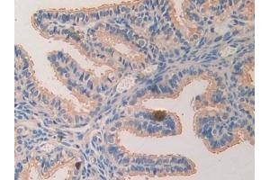 Immunohistochemistry (IHC) image for anti-Laminin, alpha 4 (LAMa4) (AA 457-630) antibody (ABIN7438160)