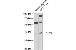 Western blot analysis of extracts of various cell lines, using EIF2B2 antibody (ABIN6132131, ABIN6140037, ABIN6140038 and ABIN6222805) at 1:1000 dilution. (EIF2B2 Antikörper  (AA 1-351))