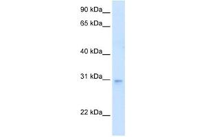 LDB3 antibody used at 0.