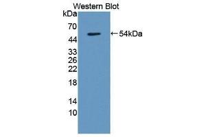 Western Blotting (WB) image for anti-Transmembrane Protein 27 (TMEM27) (AA 15-141) antibody (ABIN1871658) (TMEM27 Antikörper  (AA 15-141))