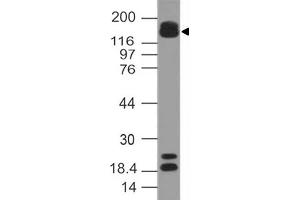 Image no. 1 for anti-AT Rich Interactive Domain 5B (MRF1-Like) (ARID5B) (AA 430-621) antibody (ABIN5027366) (ARID5B Antikörper  (AA 430-621))