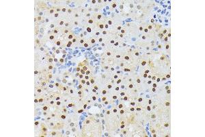 Immunohistochemistry of paraffin-embedded mouse kidney using EL antibody (ABIN6132052, ABIN6140108, ABIN6140109 and ABIN6222942) at dilution of 1:200 (40x lens). (ELAC2 Antikörper  (AA 1-270))