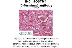 Image no. 1 for anti-Sequestosome 1 (SQSTM1) (C-Term) antibody (ABIN1739629) (SQSTM1 Antikörper  (C-Term))