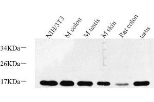 Western Blot analysis of various samples using Survivin Polyclonal Antibody at dilution of 1:600. (Survivin Antikörper)