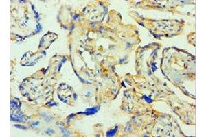 Immunohistochemistry of paraffin-embedded human placenta tissue using ABIN7171585 at dilution of 1:100 (TTBK2 Antikörper  (AA 1185-1244))