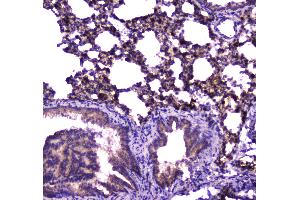 IHC analysis of FABP5 using anti-FABP5 antibody . (FABP5 Antikörper)