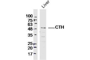 Lane 1: Mouse liver lysates probed with CTH Polyclonal Antibody, Unconjugated  at 1:300 overnight at 4˚C. (CTH Antikörper)
