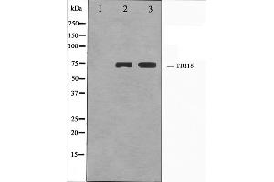 Western blot analysis on A549 and HuvEc cell lysate using TRI18 Antibody. (MID1 Antikörper  (N-Term))
