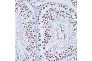 Immunohistochemistry of paraffin-embedded rat testis using DNMT3L antibody (ABIN3023228, ABIN3023229, ABIN3023230 and ABIN6219498) at dilution of 1:100 (40x lens). (DNMT3L Antikörper  (AA 1-386))