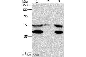 Western blot analysis of Hela cell, mouse testis tissue and Jurkat cell, using SPDL1 Polyclonal Antibody at dilution of 1:400