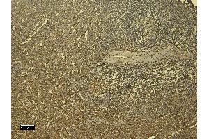 Immunohistochemistry (IHC) image for anti-Ionized Calcium-binding Adapter Molecule 1 (IBA1) (C-Term) antibody (ABIN184738)