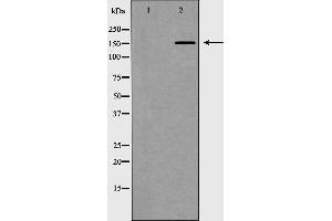 Western blot analysis of extracts of Jurkat, using MED1 antibody. (MED1 Antikörper  (Internal Region))