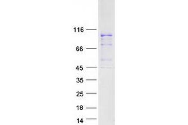 TFIP11 Protein (Transcript Variant 1) (Myc-DYKDDDDK Tag)