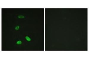 Immunofluorescence analysis of HeLa cells, using MYB antibody.