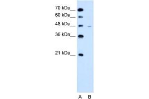 WB Suggested Anti-SLC43A3 Antibody Titration:  2.