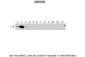 Lanes:   1: 40ng HIS-UBE2D1 protein 2: 40ng HIS-UBE2D2 protein 3: 40ng HIS-UBE2D3 protein 4: 40ng HIS-UBE2D4 protein 5: 40ng HIS-UBE2E1 protein 6: 40ng HIS-UBE2E2 protein 7: 40ng HIS-UBE2E3 protein 8: 40ng HIS-UBE2K protein 9: 40ng HIS-UBE2L3 protein 10: 40ng HIS-UBE2N protein 11: 40ng HIS-UBE2V1 protein 12: 40ng HIS-UBE2V2 protein. (UBE2D2 Antikörper  (N-Term))