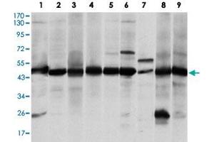 Western blot analysis of ASS1 monoclonal antibody, clone 2B10  against A-431 (1), RAJI (2), L1210 (3), MOLT4 (4), Jurkat (5), A-549 (6), NIH/3T3 (7), PC-12 (8) and COS-7 (9) cell lysate. (ASS1 Antikörper)