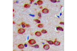 Immunohistochemical analysis of Carbonic Anhydrase 8 staining in human brain formalin fixed paraffin embedded tissue section. (CA8 Antikörper  (Center))