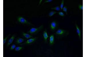 Immunofluorescent analysis of Hela cells using ABIN7173305 at dilution of 1:100 and Alexa Fluor 488-congugated AffiniPure Goat Anti-Rabbit IgG(H+L) (PVRIG Antikörper  (AA 193-326))