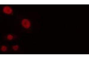 ABIN6274252 staining Hela cells by IF/ICC. (BUD31 Antikörper  (N-Term))