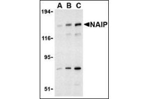 Western blot analysis of NAIP in PC-3 cell lysate with this product at (A) 0. (NAIP Antikörper  (C-Term))
