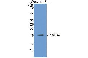 Western Blotting (WB) image for anti-Mannosidase, Alpha, Class 2B, Member 1 (MAN2B1) (AA 883-1011) antibody (ABIN1869071)