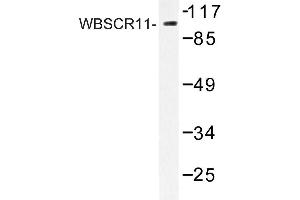 Image no. 1 for anti-General Transcription Factor II I Repeat Domain-Containing 1 (GTF2IRD1) antibody (ABIN272259) (GTF2IRD1 Antikörper)