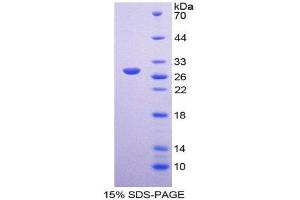 SDS-PAGE (SDS) image for Intercellular Adhesion Molecule 2 (ICAM2) (AA 29-247) protein (His tag) (ABIN2125358) (ICAM2 Protein (AA 29-247) (His tag))
