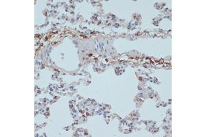 Immunohistochemistry of paraffin-embedded rat lung using HLA-DRA antibody (ABIN6131757, ABIN6141827, ABIN6141829 and ABIN6215475) at dilution of 1:100 (40x lens).