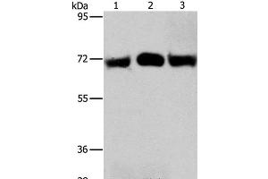 Western Blot analysis of Hela and A549 cell, Human liver cancer tissue using RPN1 Polyclonal Antibody at dilution of 1:350 (RPN1 Antikörper)