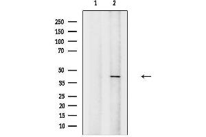 anti-Homeobox A2 (HOXA2) (Internal Region) antibody