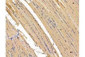 ABIN7095944 and ABIN7100006 at 1/100 staining rat muscle tissue by IHC-P. (CHMP5 Antikörper)