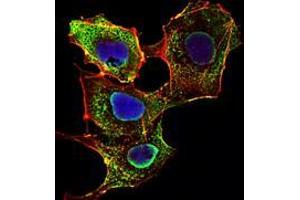 Immunofluorescence analysis of NIH/3T3 cells using SMAD3 mouse mAb (green). (SMAD3 Antikörper)