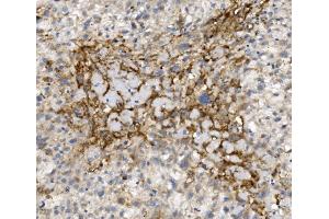 IHC analysis of CCR2 using anti-CCR2 antibody (ABIN7600349).