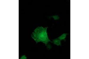Anti-ADH1B mouse monoclonal antibody (ABIN2454477) immunofluorescent staining of COS7 cells transiently transfected by pCMV6-ENTRY ADH1B (RC205391). (ADH1B Antikörper)