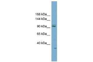 RC3H2 antibody used at 1 ug/ml to detect target protein. (RC3H2 Antikörper  (Middle Region))