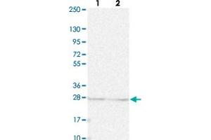 Western blot analysis of Lane 1: Human cell line RT-4 Lane 2: Human cell line U-251MG sp with KPNA1 polyclonal antibody  at 1:250-1:500 dilution. (KPNA1 Antikörper)