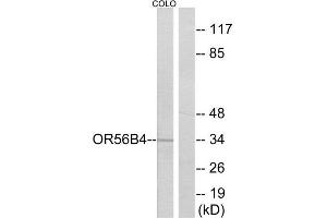 Western Blotting (WB) image for anti-Olfactory Receptor, Family 56, Subfamily B, Member 4 (OR56B4) (C-Term) antibody (ABIN1853150) (OR56B4 Antikörper  (C-Term))