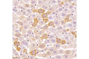 Immunohistochemistry of paraffin embedded mouse liver using Kiaa1324 (ABIN7073822) at dilution of 1:2500 (400x lens) (ELAPOR1 Antikörper)