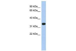 SULT1B1 antibody used at 1 ug/ml to detect target protein. (SULT1B1 Antikörper  (N-Term))