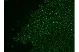 Formalin-fixed, paraffin-embedded human colol carcinoma stained with AF488-conjugated Nucleolin MAb (364-5 + NCL/902). (Nucleolin Antikörper)